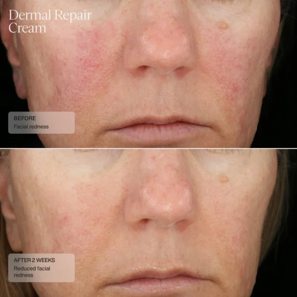 Dermal Repair Cream - Image 5