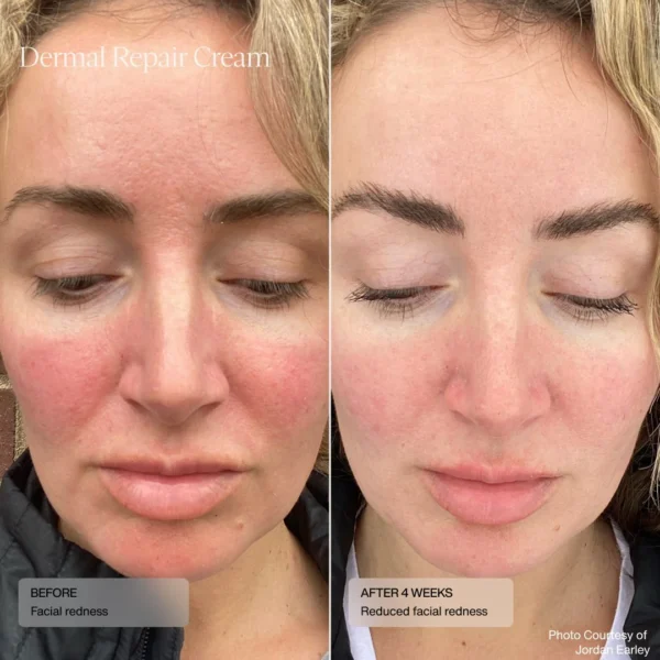 Dermal Repair Cream - Image 7