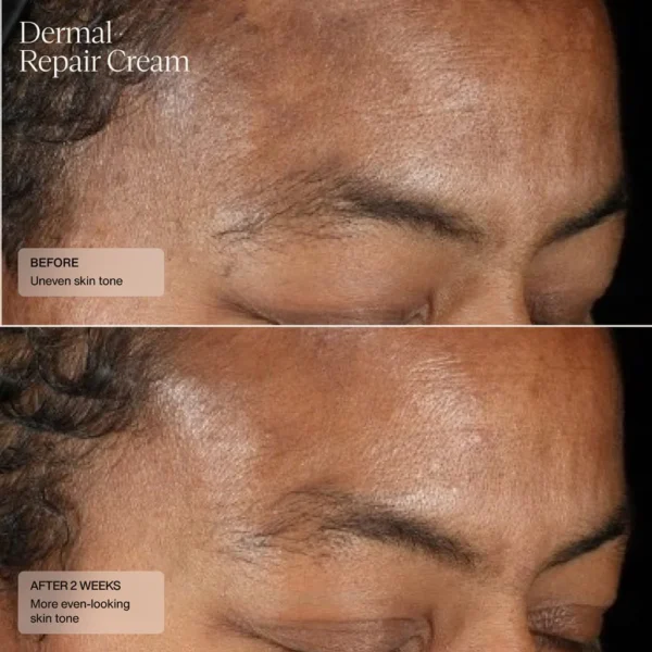 Dermal Repair Cream - Image 3