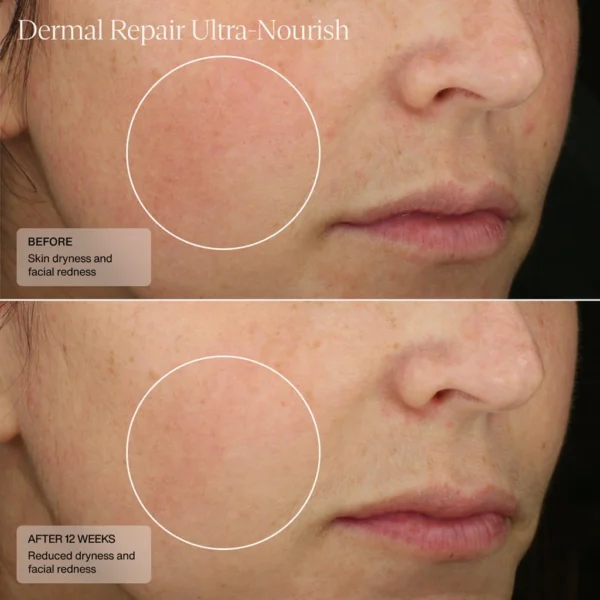 Dermal Repair Ultra-Nourish - Image 5