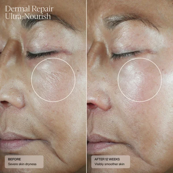 Dermal Repair Ultra-Nourish - Image 6