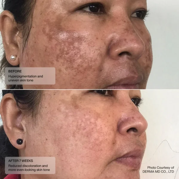 Even Tone Retinol Cream - Image 5