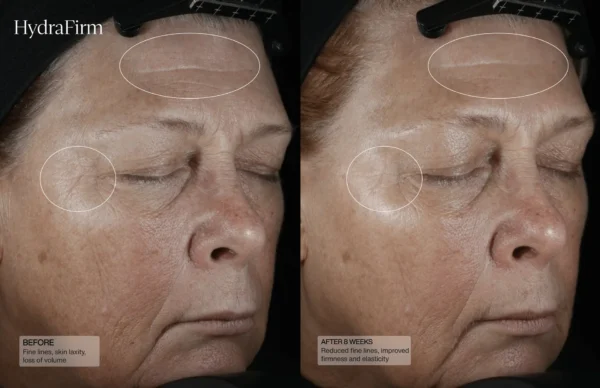 HydraFirm (Dermal Contour Pressed Serum) - Image 2