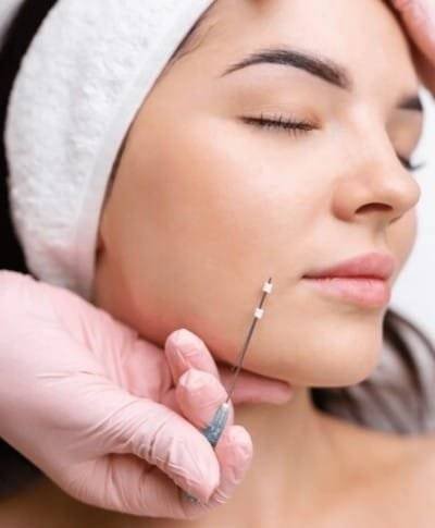 Cheek filler injection during facial aesthetics treatment at MyBioGlow Med Spa.
