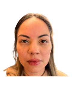 After Image: Lip Filler