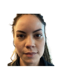 Before Image: Lip Filler