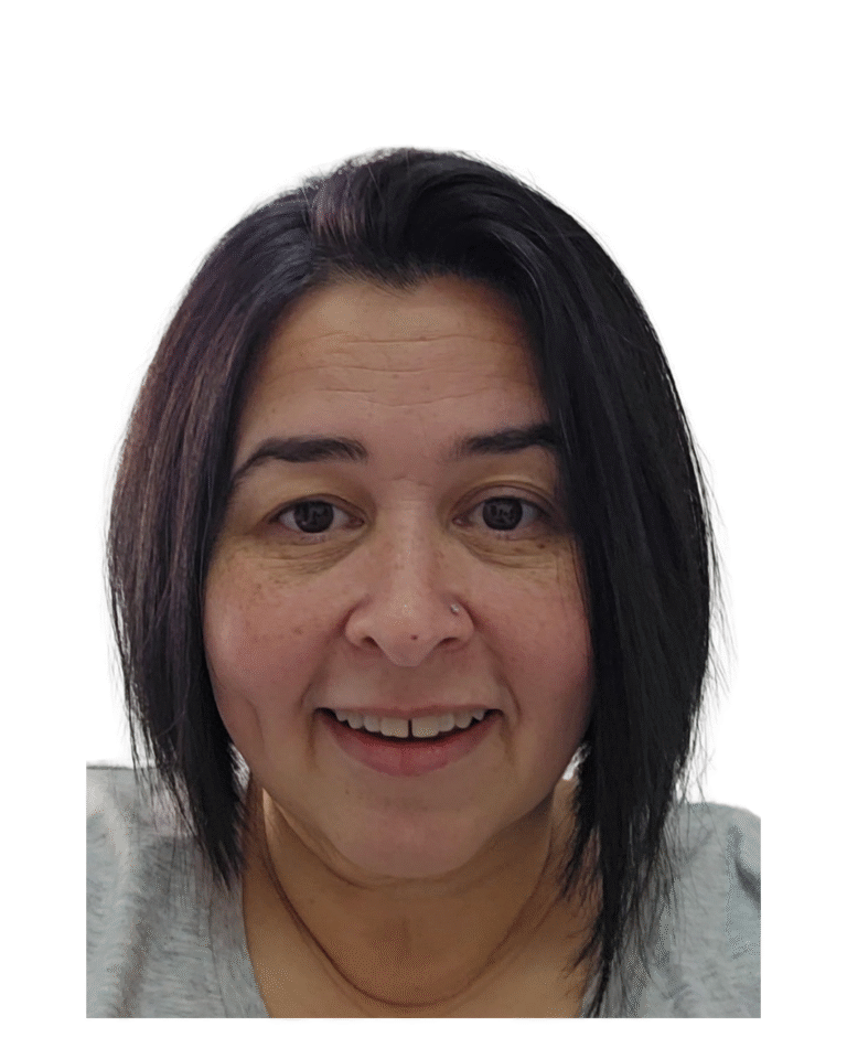 Before Image: Microneedling - front